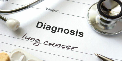Lung Cancer – Types, Causes, and Symptoms