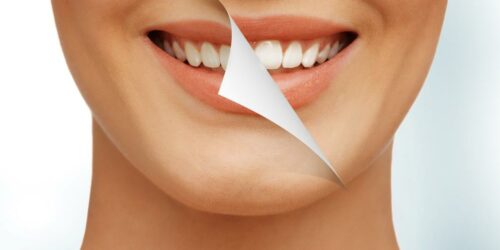 Bad Oral Health Habits You Should Avoid