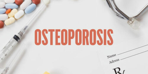 Bone density testing – An important diagnostic tool for osteoporosis