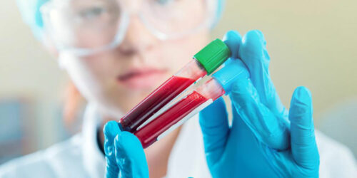 Here’s why maintaining normal creatinine levels is imperative