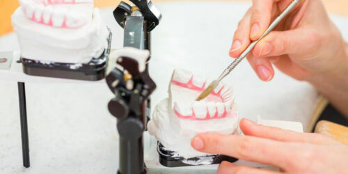 Lower Dentures – Signs that you need them