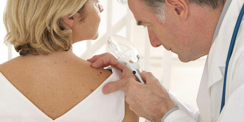 Metastatic malignant melanoma – types of treatment