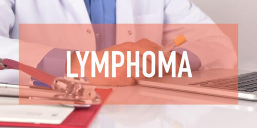 Non Hodgkin Lymphoma treatment – Symptoms, causes and more explained