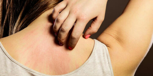 Seasonal allergies – An overview