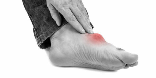 Top triggers for gout foot pain