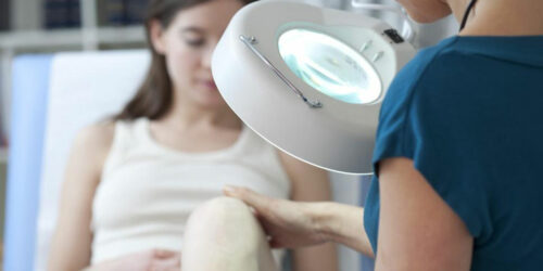 When to see a doctor if you have Baker’s cyst