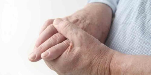 5 Best Gout Treatments