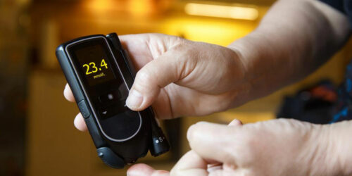 A1C Level Chart – An Effective Diabetes Management Tool