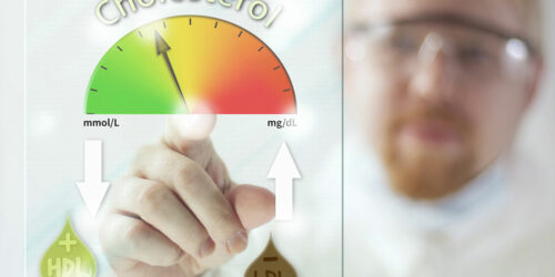 All You Need to Know about High Cholesterol Levels