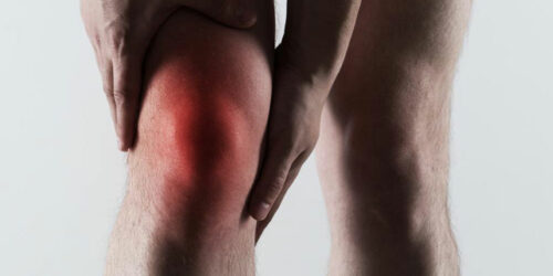 Gout – Diagnosis and Foods to Avoid