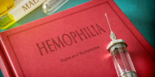 Hemophilia – 4 main symptoms and their severity