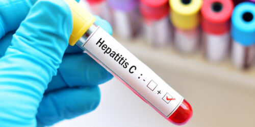 Hepatitis – types and contributing factors