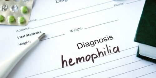 Here’s what to eat for hemophilia