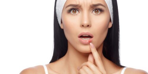 Herpes – Types And Preventive Measures