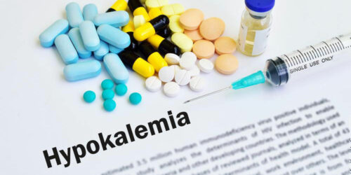 Hypokalemia – what you should know