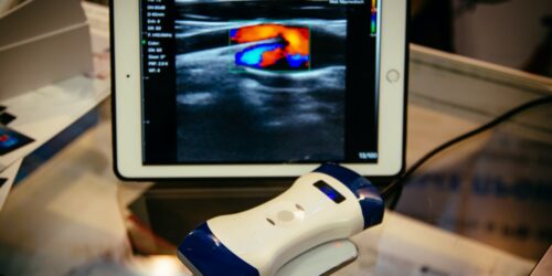 Portable ultrasound machines – Types and top choices