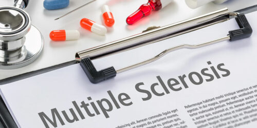 Stages, diagnosis, and prevention of multiple sclerosis