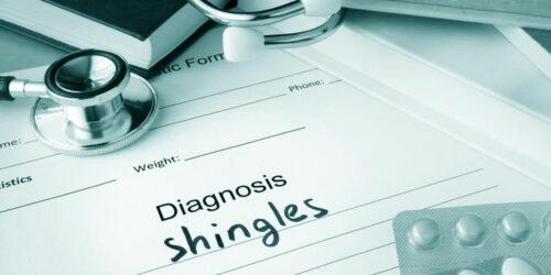 The Best Medication and Natural Treatments for Shingles