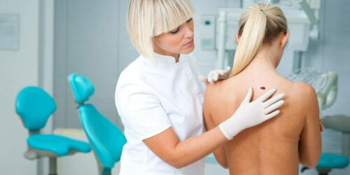 You Probably Didn’t Know That Melanoma Symptoms Can Appear Inside This Delicate Body Part
