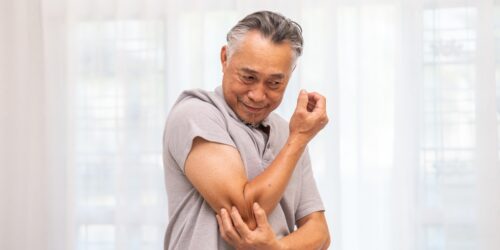 Understanding Psoriasis in the Elderly Recognizing and Managing Plaque Psoriasis